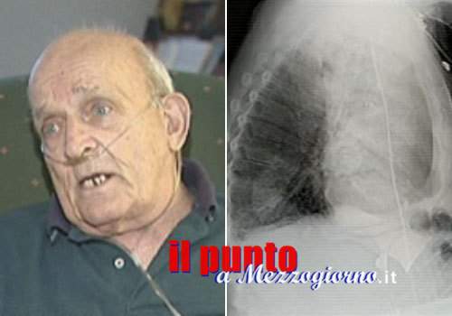 Quando una piantina di piselli germoglia in un polmone