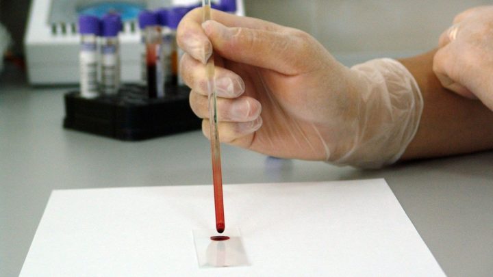 Coronavirus, D’Amato: “Sui test sierologici necessaria strategia nazionale”