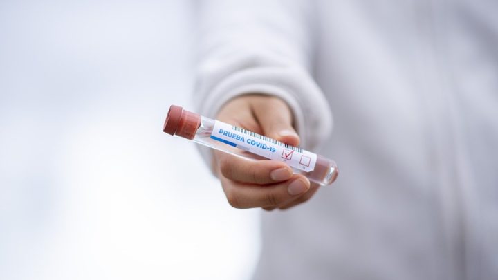 Coronavirus – Asl Frosinone, da oggi 5 giugno test sierologici per tutti i cittadini