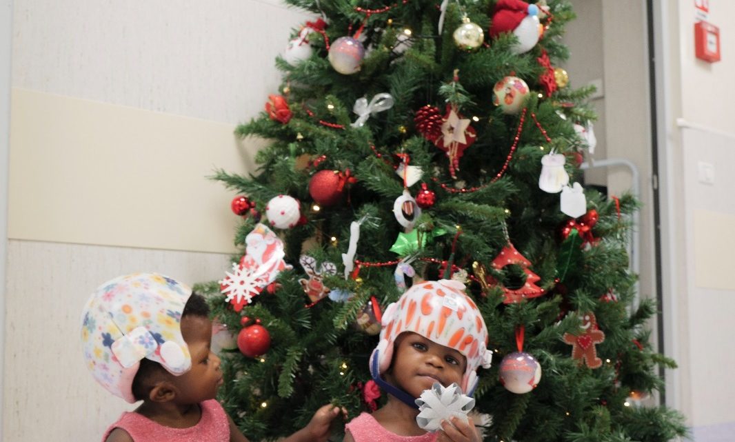 Al Bambino Gesù di Roma si festeggia il Natale con il sorriso delle gemelline siamesi Al Bambino Gesù di Roma si festeggia il Natale con il sorriso delle gemelline siamesi