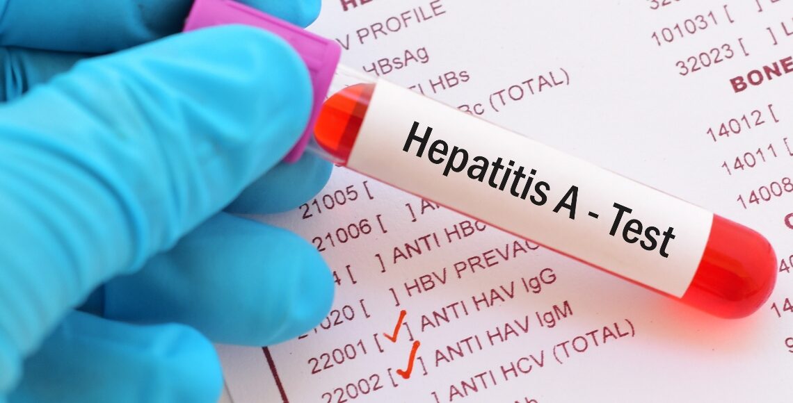 Emergenza Epatite A, 24 casi in provincia di Latina. La Asl istituisce task force per controlli